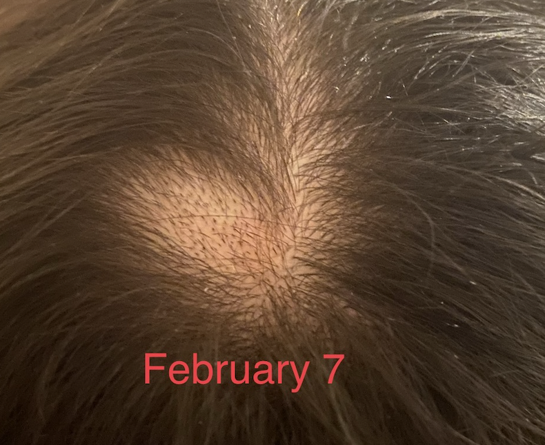 Diagnosis — QUESTION OF THE WEEK — Donovan Hair Clinic