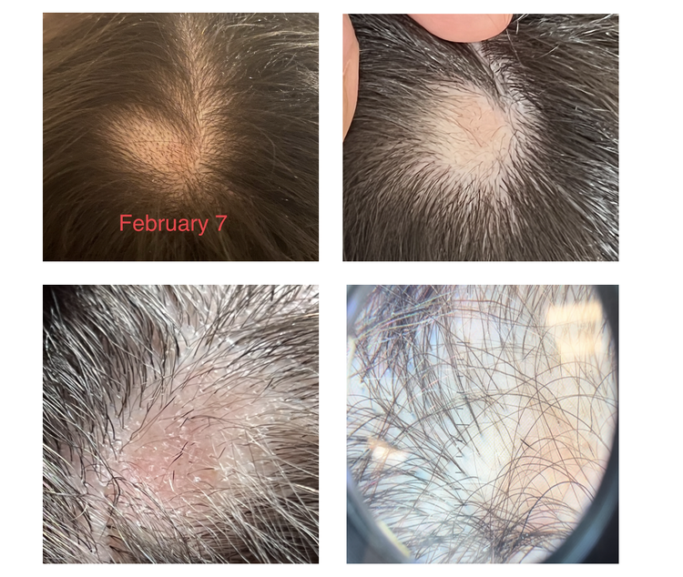 Diagnosis — QUESTION OF THE WEEK — Donovan Hair Clinic
