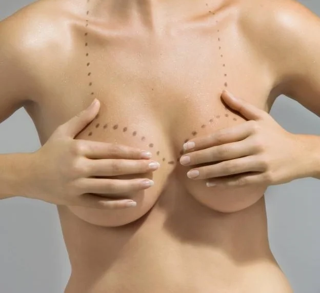 Qué tamaño elegir el Aumentar Busto?