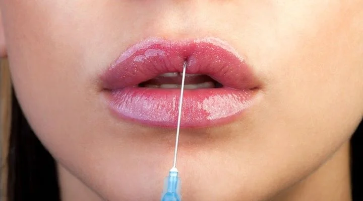 ¿Quieres aumentar el tamaño de tus labios?