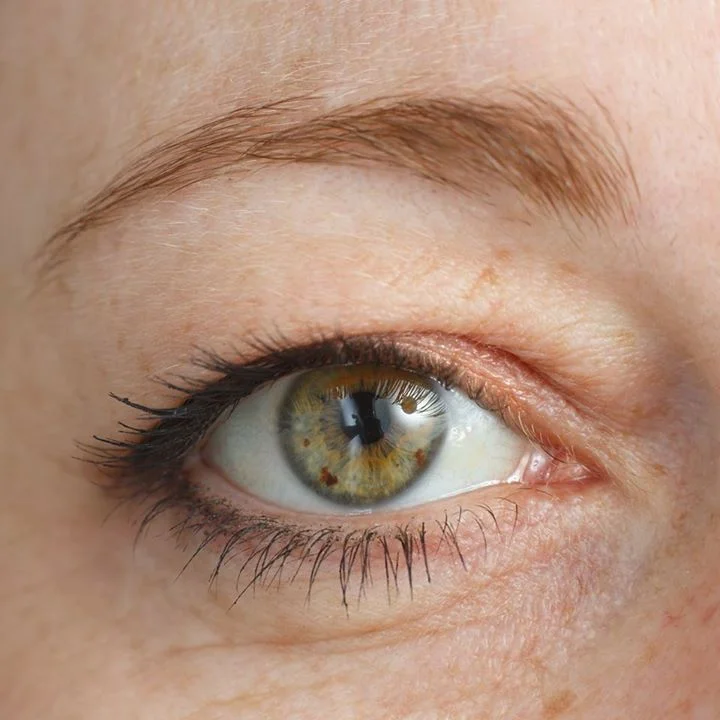 Cirugía de párpados