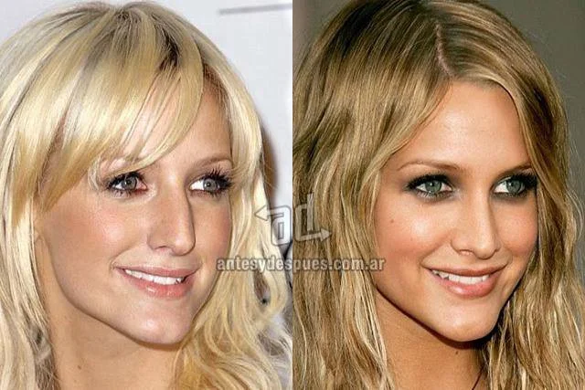 ¿Quieres una nariz perfecta?