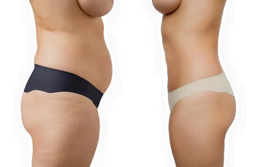 ¿Quieres lucir un cuerpo sin la famosa pancita?