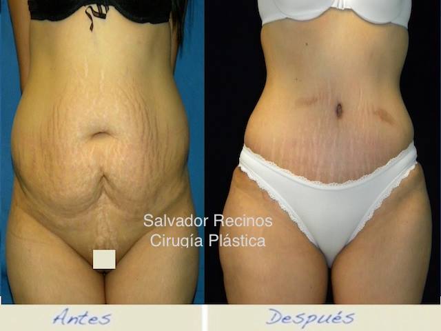 Define tú Cintura y Reafirma el Abdomen! 