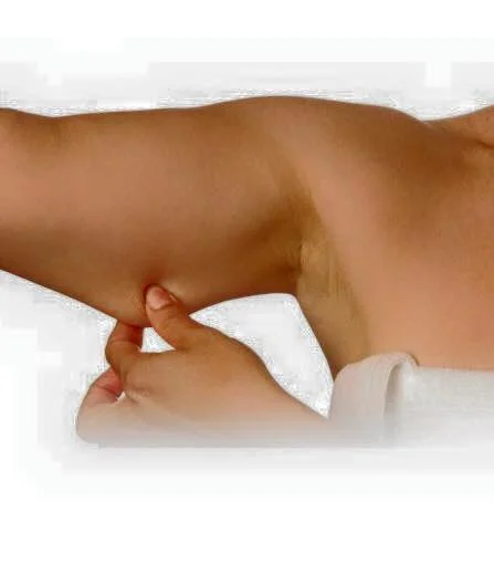 Corrección de flacidez.