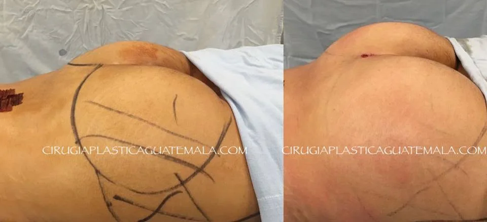 Luce sexy! Con un AUMENTO de GLÚTEO.