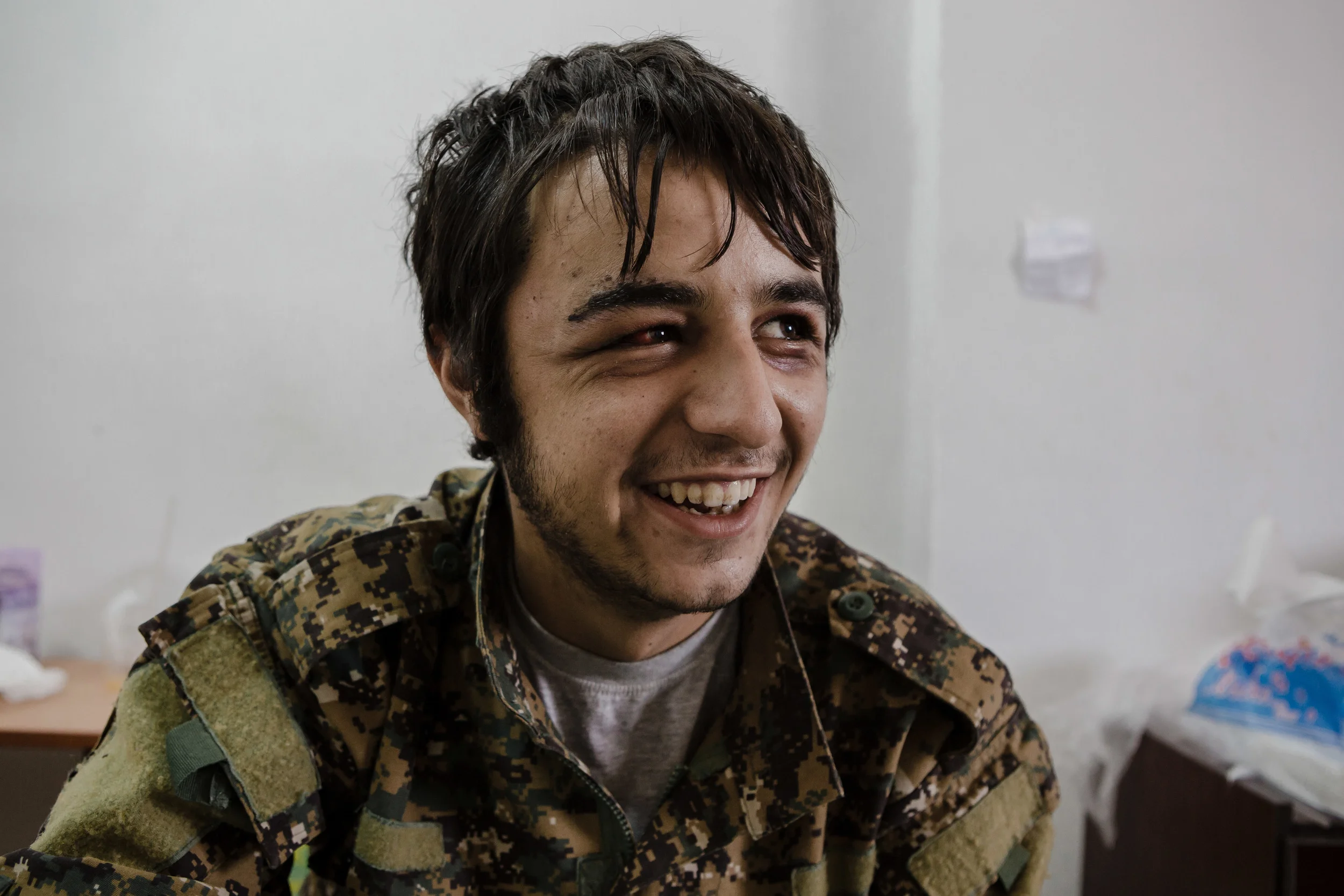 Shergar - Kurdish for revolution - is a commander in the YPG at the age of 22. He is recovering from an IED explosion that caused damage to his arms and face.