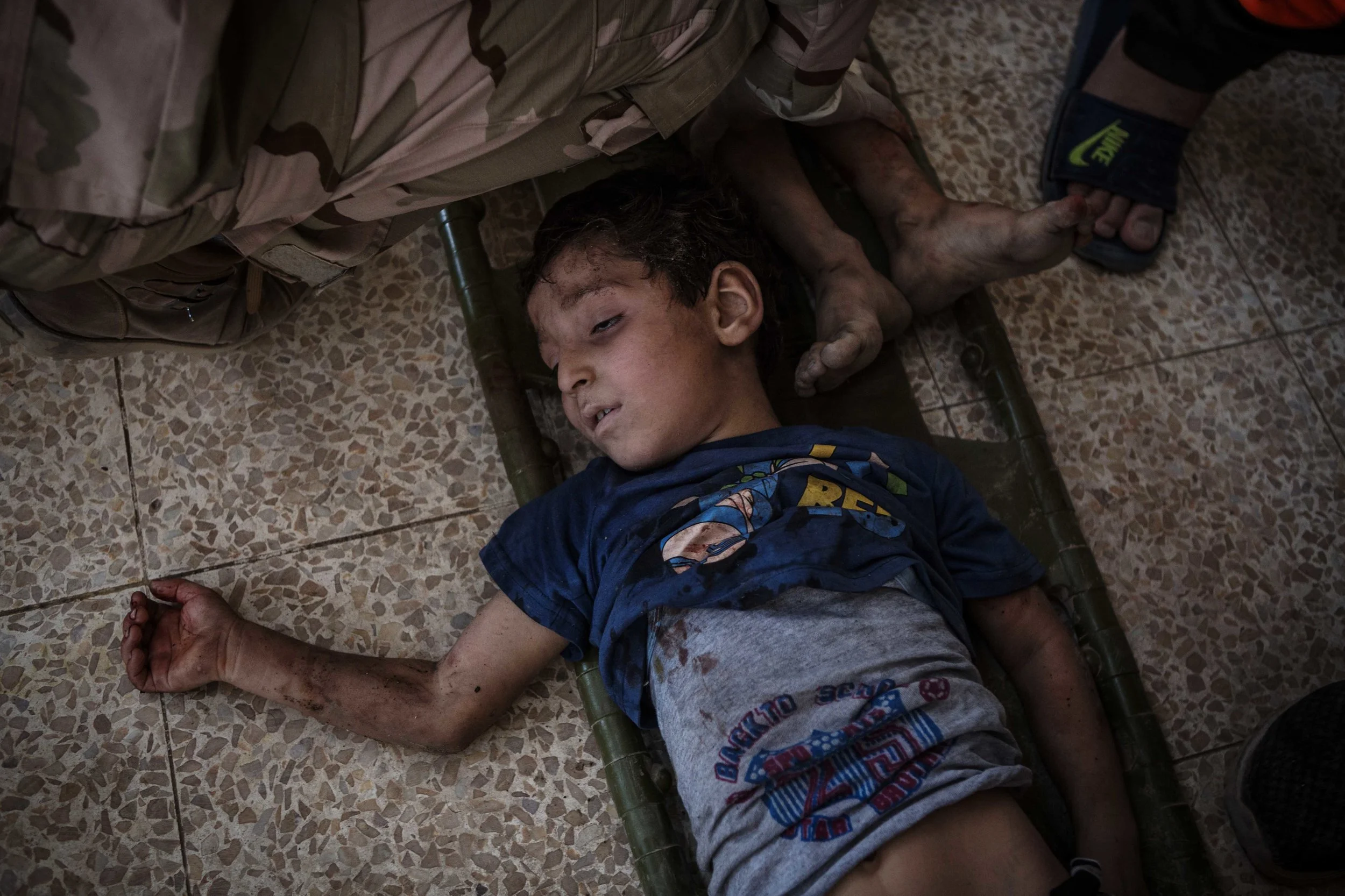 An injured child waits for treatment at an Iraqi army Causality Collection Point (CCP) along the frontline in western Mosul. Thousands of civilians fled the ongoing fighting between the Iraqi forces and the Islamic State as the Iraqi forces push to remove the militants from their last remaining districts in western Mosul.
