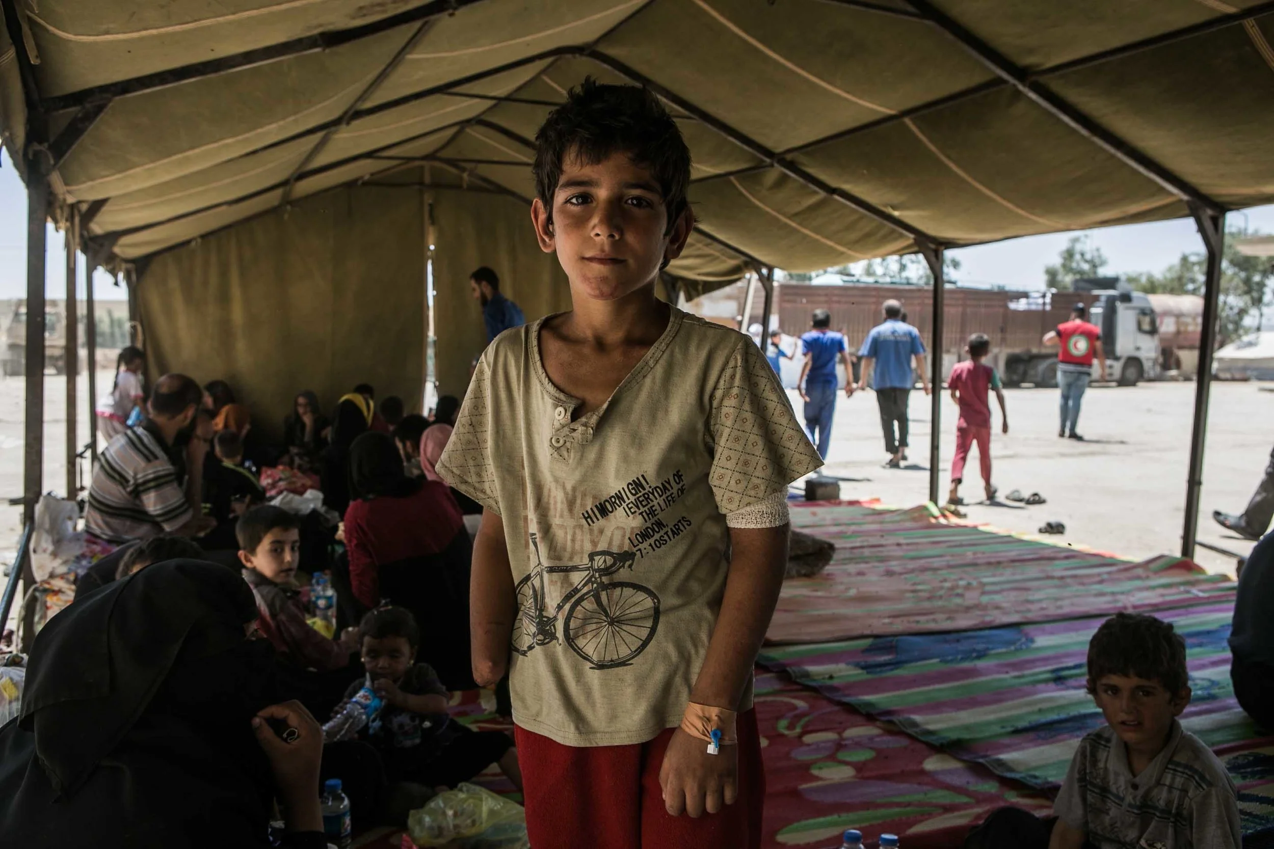 A young boy who lost his hand in Mosul waits with his family to be relocated to one of the displaced people’s camps south of Mosul. His mother says his hand was injured by a mortar falling in western Mosul and doctors provided by the Islamic State saved his life. 