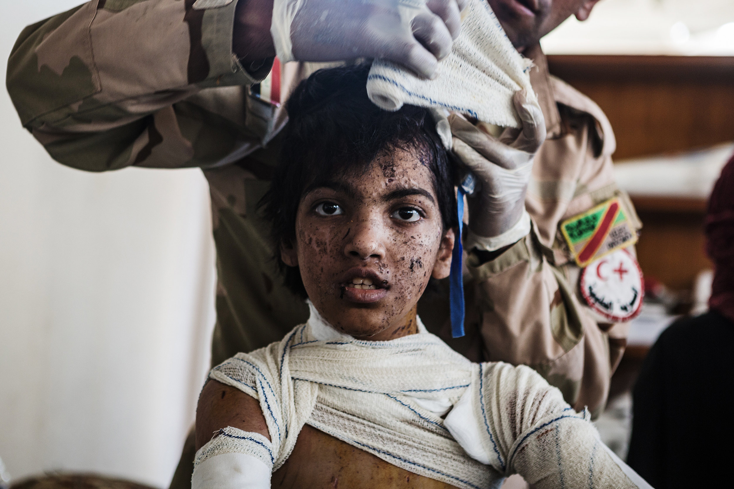  A dazed child receives medical treatment at an Iraqi army medical unit after fleeing heavy fighting in al-Zinjili neighborhood. June 03, 2017.  