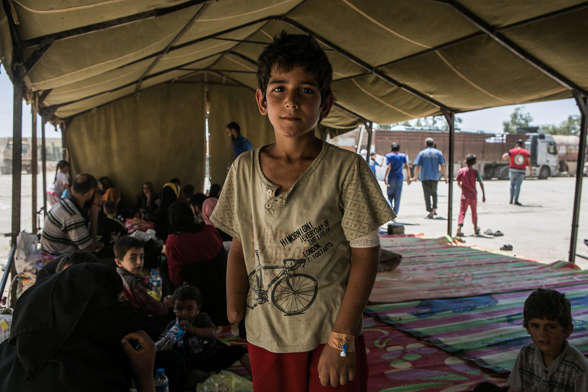  A young boy who lost his hand due to fighting in Mosul waits with his family to be relocated to one of the displaced people’s camps south of Mosul. His mother says his hand was injured by a mortar falling in western Mosul and that Islamic State doct