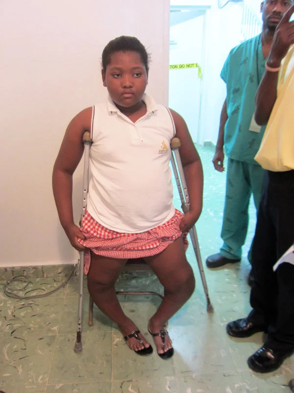 Adolescent-with-severe-Blount's-disease-web.jpg