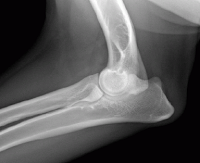 normal elbow.png