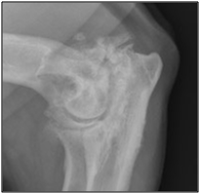 End stage osteoarthritis of canine elbow.png