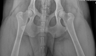 normal pelvis.png