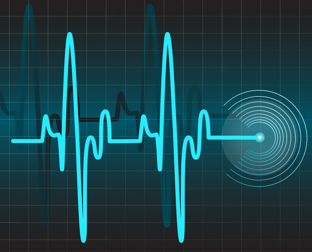 bigstock-Electrocardiogram-25683449.jpg