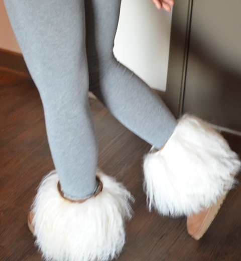 uggs with fur cuff