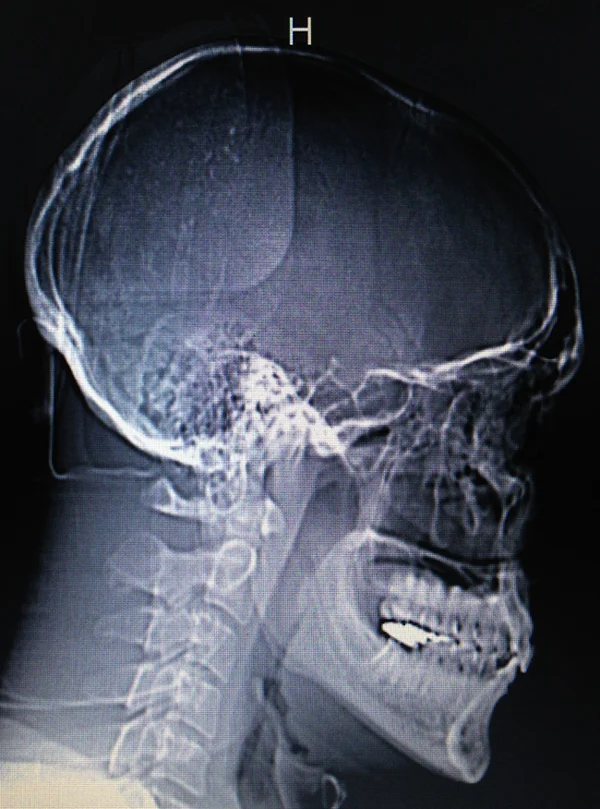 CT Scan Image 12/4/2013 - Dr. Visit