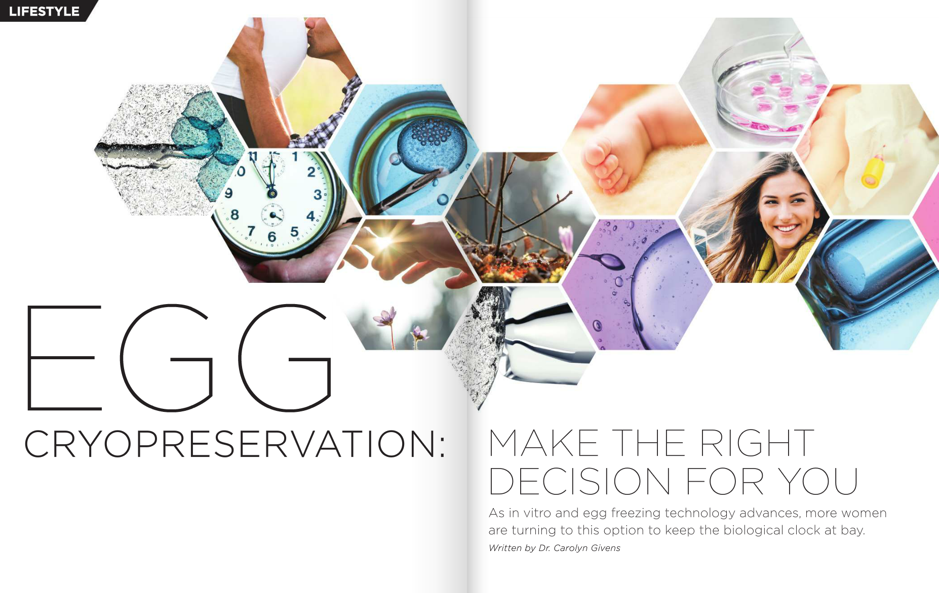 Egg Cryopreservation