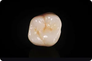zirconia01.jpg