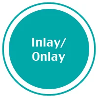 4-inlay_onlay.jpg