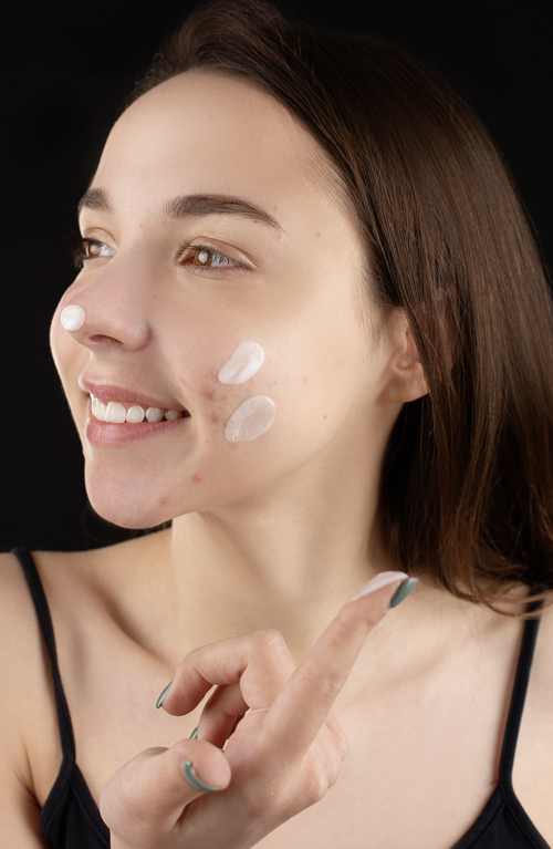 Don't pop that pimple - do this instead.