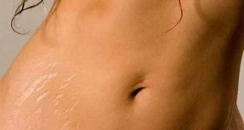 Home Remedies for Common Skin Disorders
