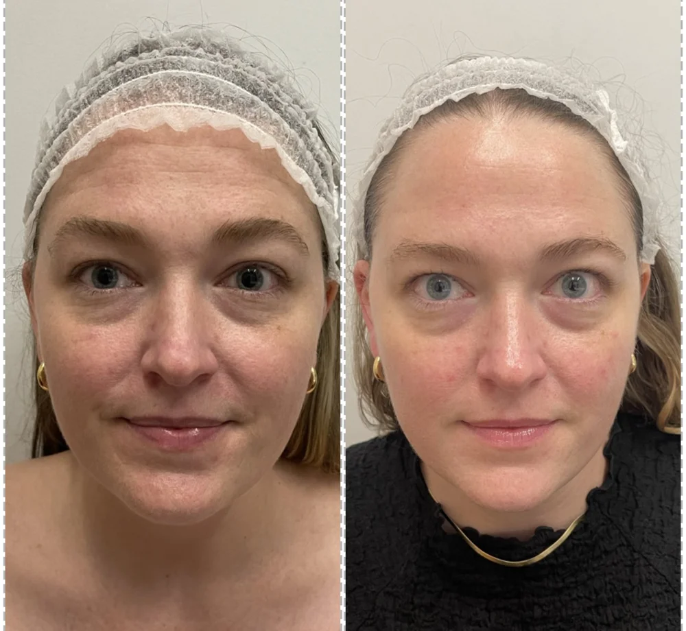 Before And After Skincare Routine: Transform Your Skin Today