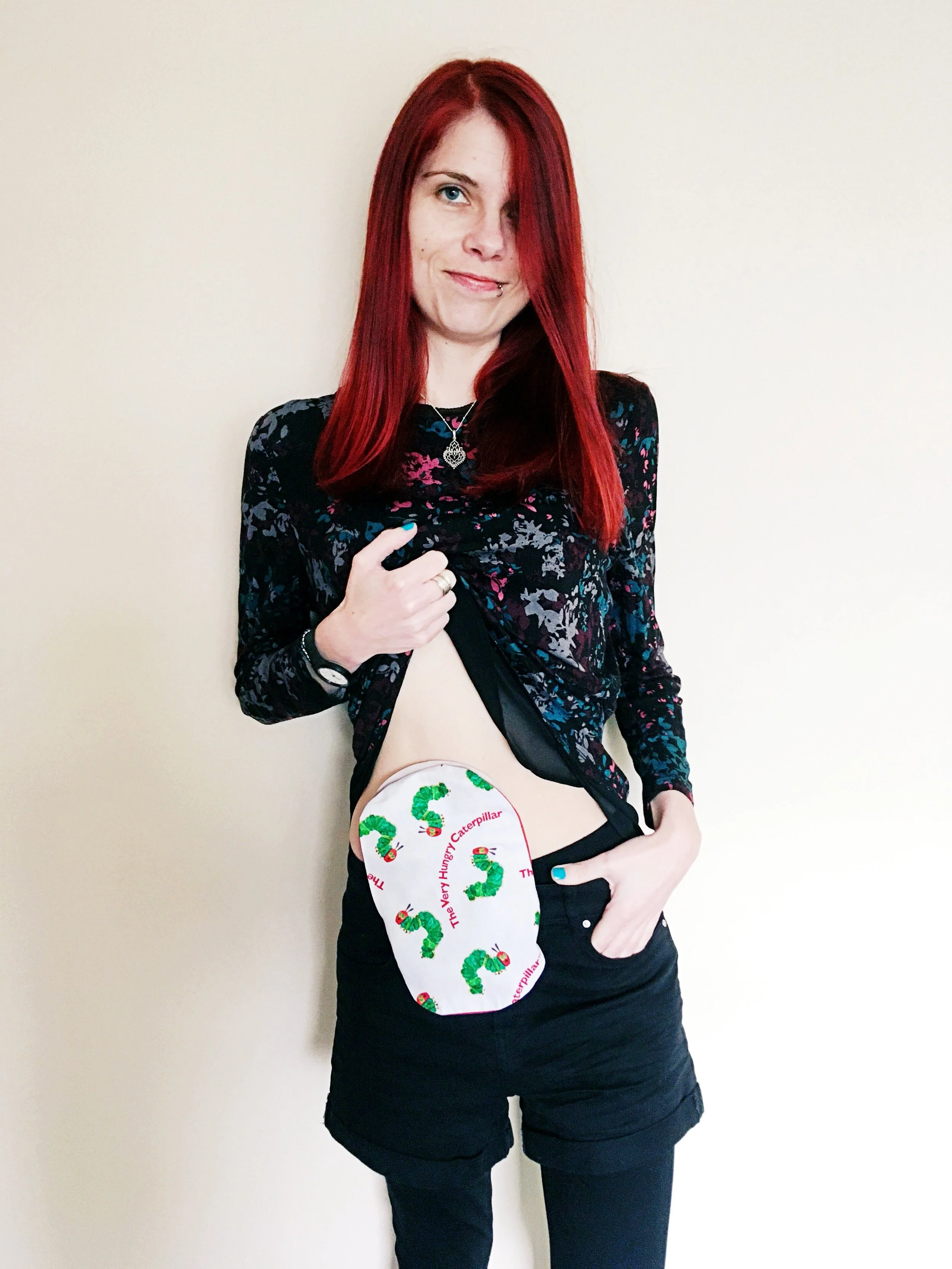 The Priceless Lessons My Stoma Bag Has Taught Me