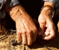 Millions of people with arthritis unnecessarily suffer from pain