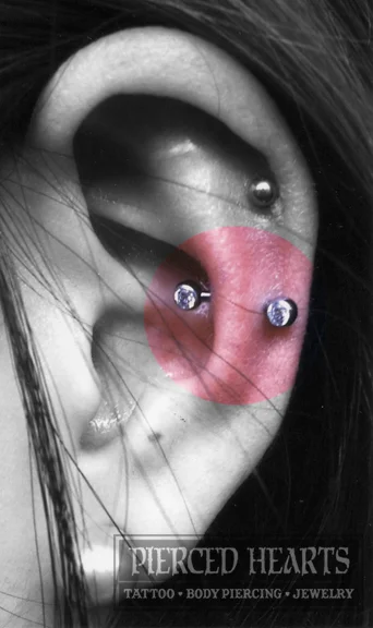 ANTI-HELIX