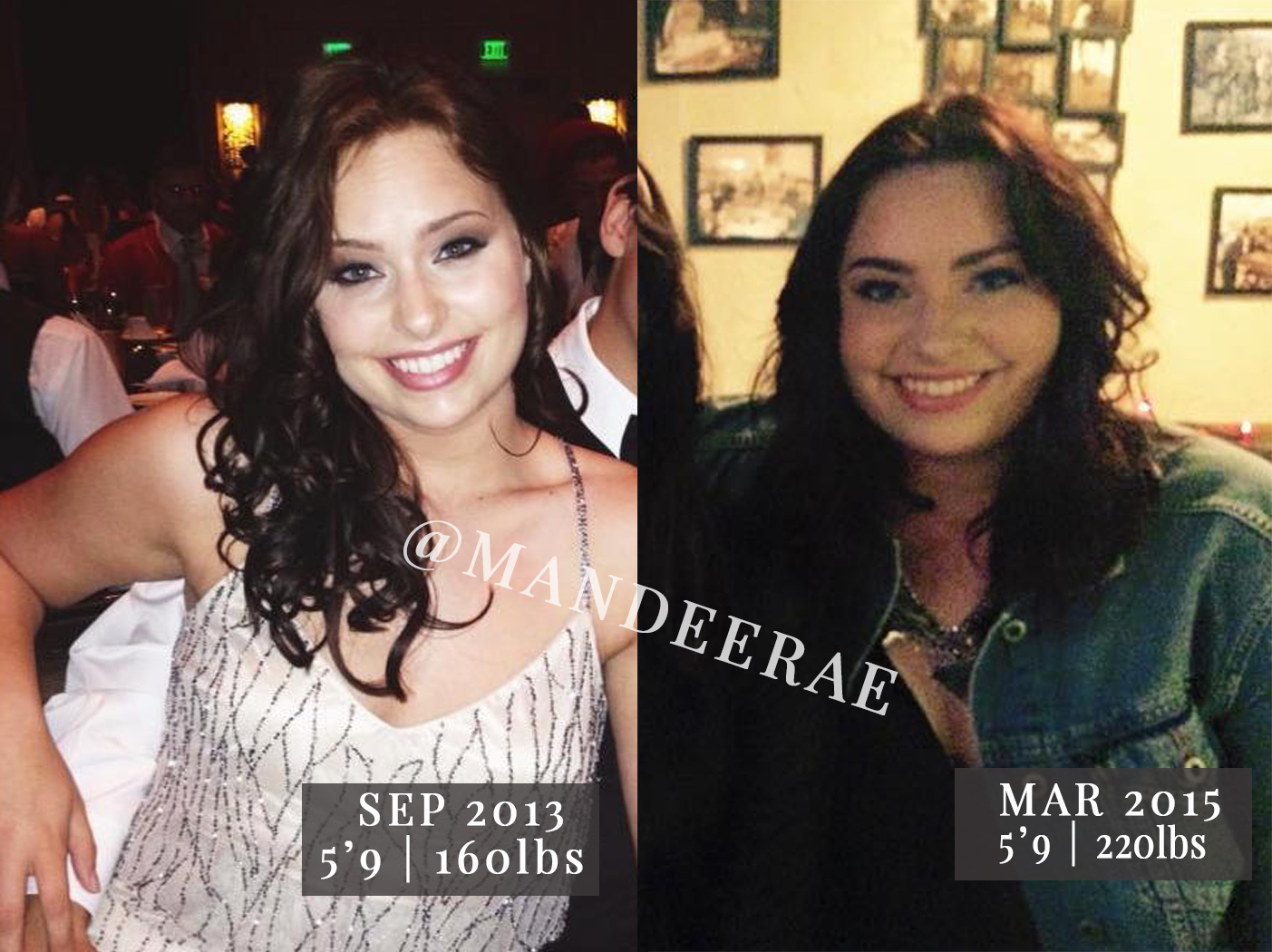 Weight loss after removing mirena