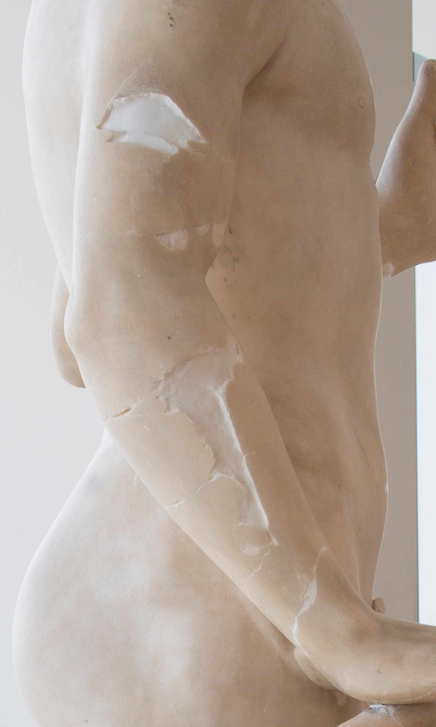 7. Tullio Lombardo's Adam--A Masterpiece Restored_Right Arm During Fills-Switch Removed_MMA.jpg