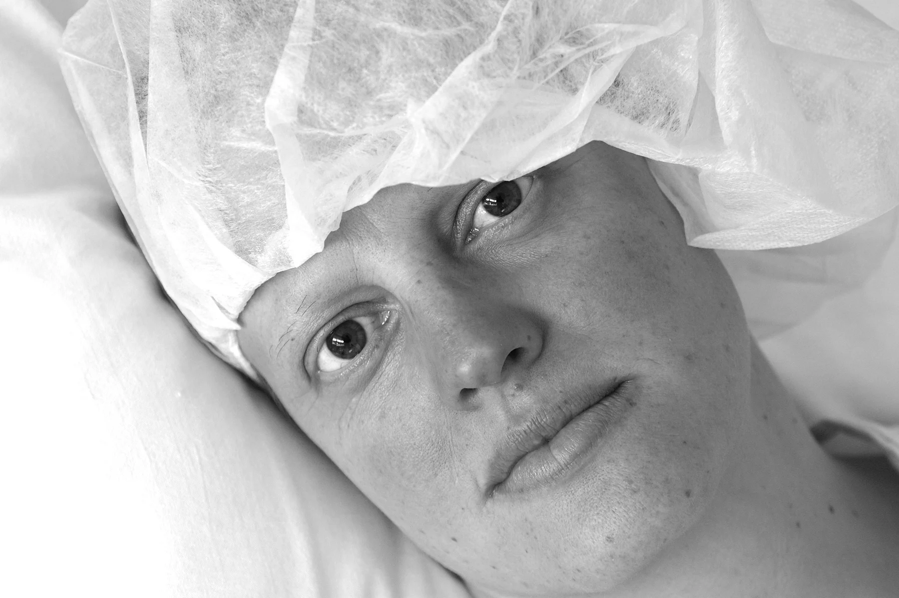 (21) kc pre surgery.jpg