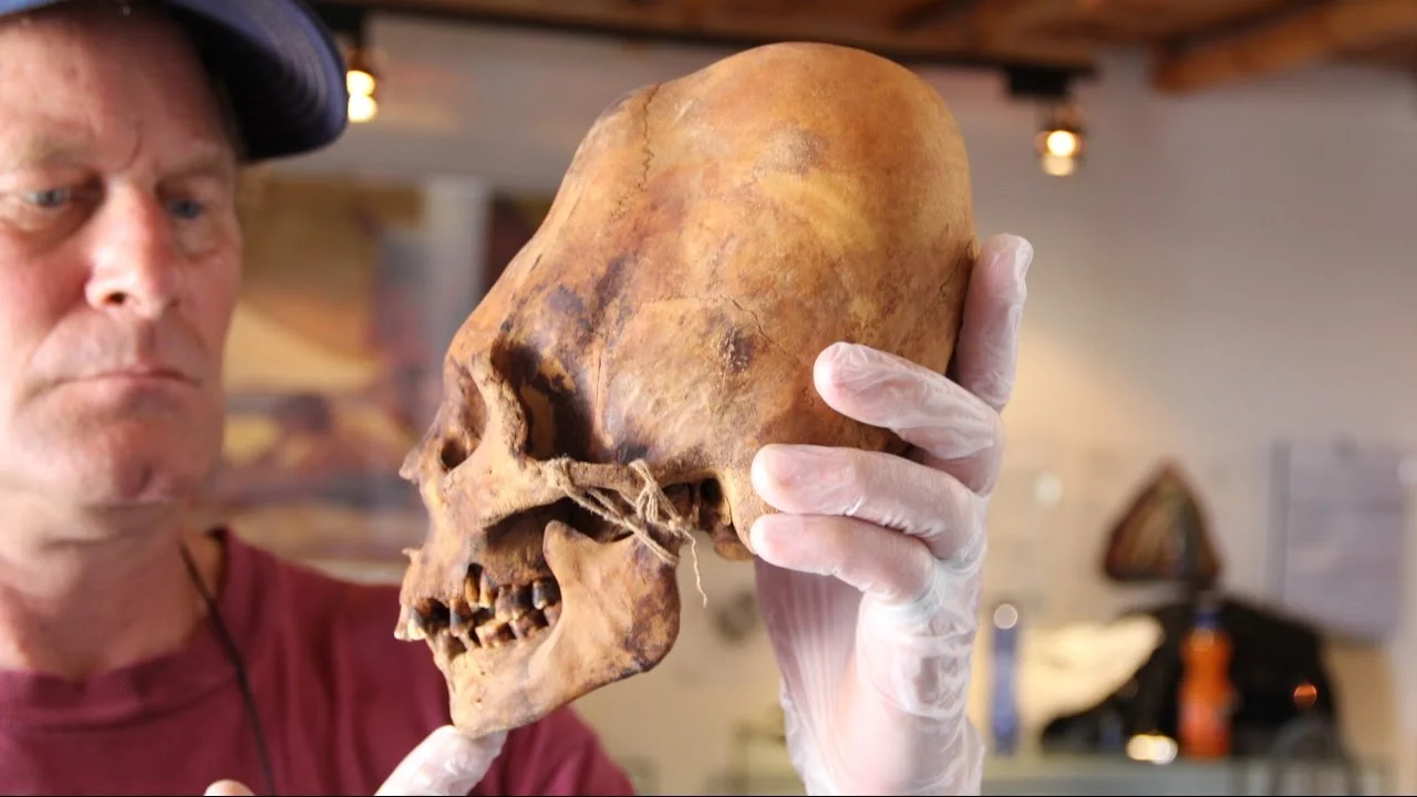Brien Foerster with an elongated skull. Image by Brien Foerster.