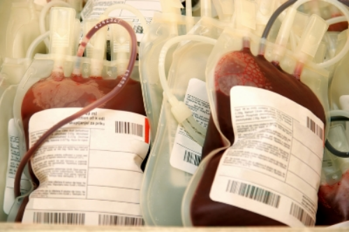 cutcaster-800966212-Platelet-concentrate-small.jpg