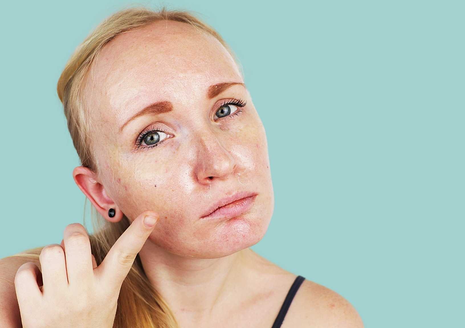 Tips to Balance Combination Skin — Moody Sisters Skincare