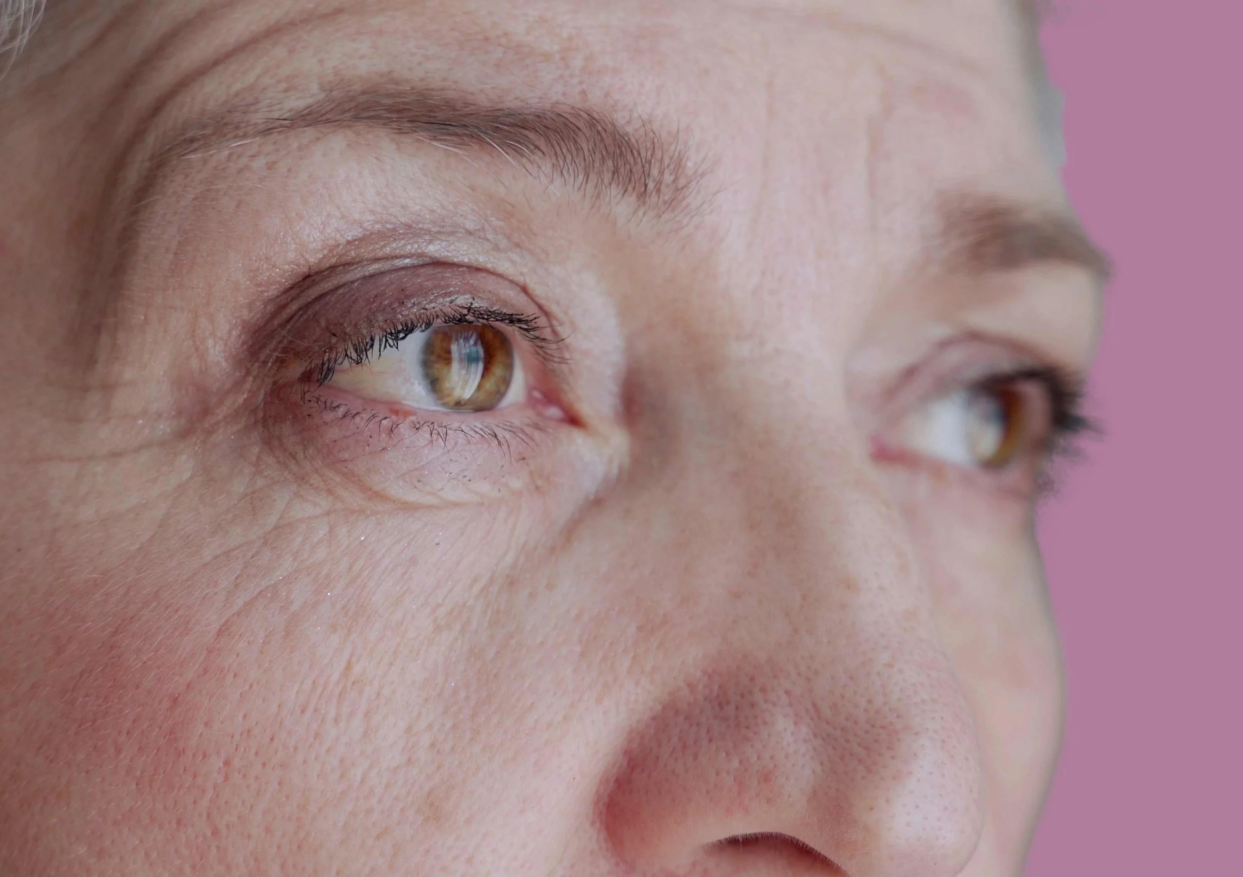 What Causes Dark Spots On Skin Moody Sisters Skincare what-causes-dark-spots-on-skin-moody-sisters-skincare