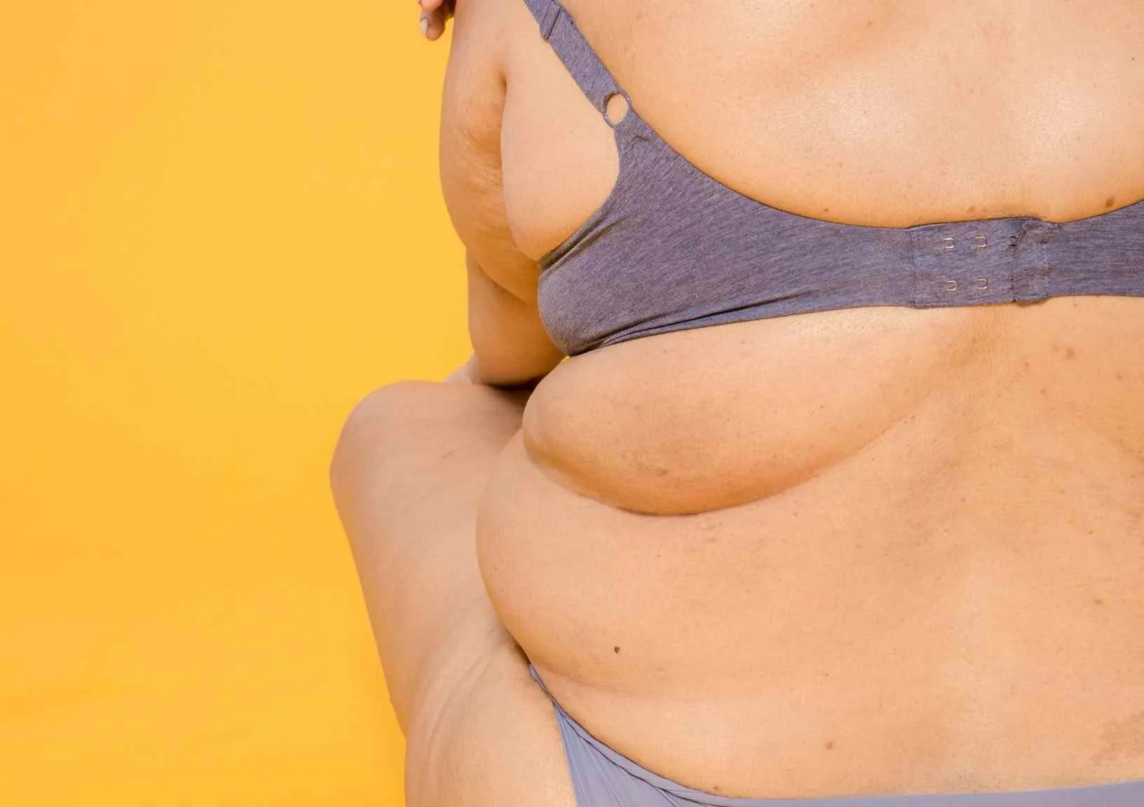 What is cellulite? And what causes it? — Moody Sisters Skincare