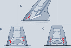 Figure 1. A - Rotation B - Mediolateral rotation C - Symmetrical distal displacement or "Sinking"