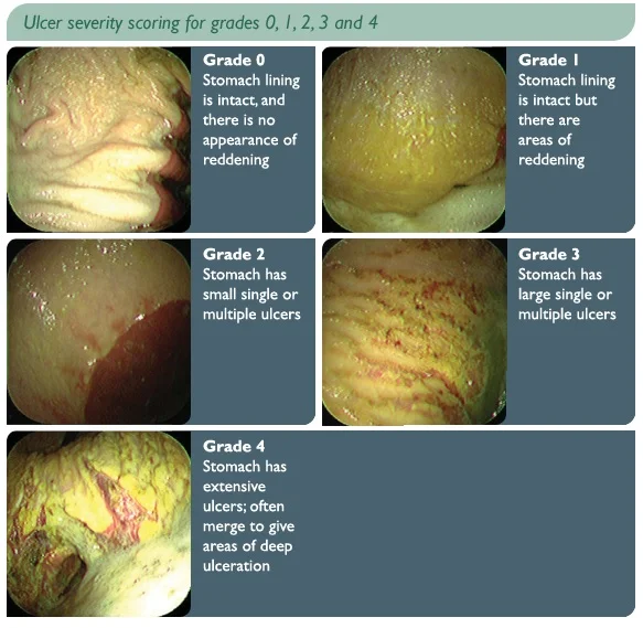 Bilde lånt fra: http://equinevision.blogspot.no/2013/05/equine-gastric-ulcer-syndrome-egus.html