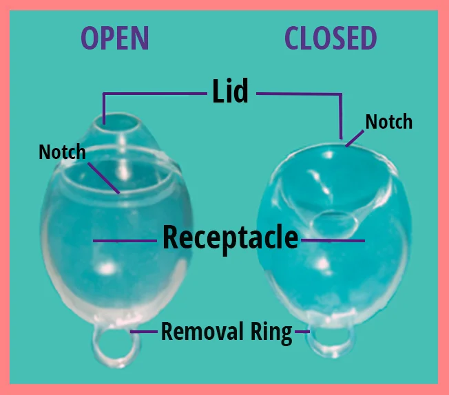 OpenClosed English.jpg