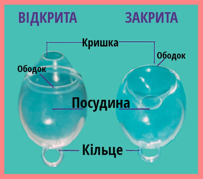 OpenClosed.jpg