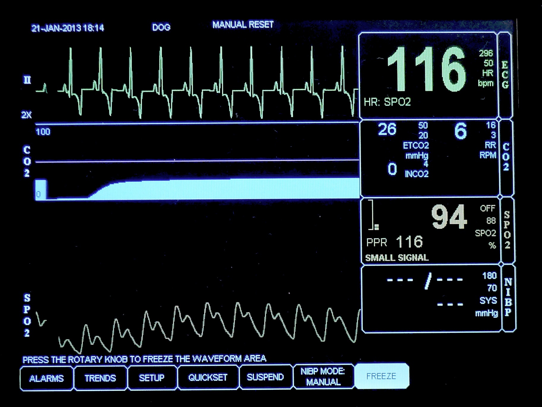 ECG3.jpeg