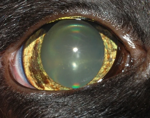 iris melanoma.jpeg