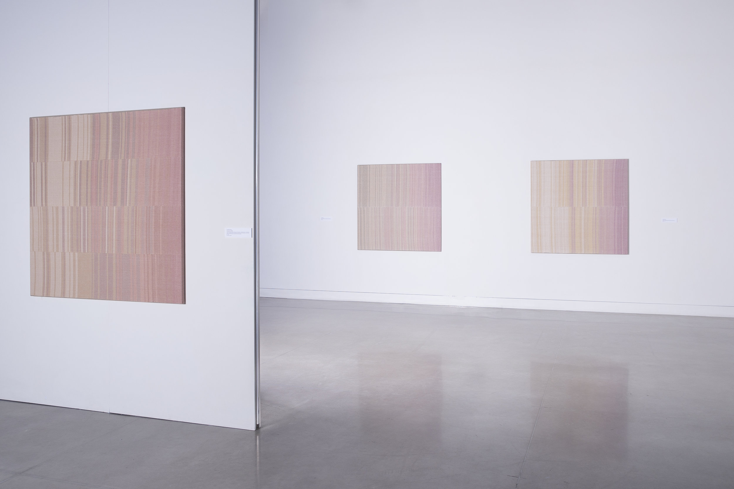 4 Weinberg_Tali_Fractures1-3_Installation.jpg