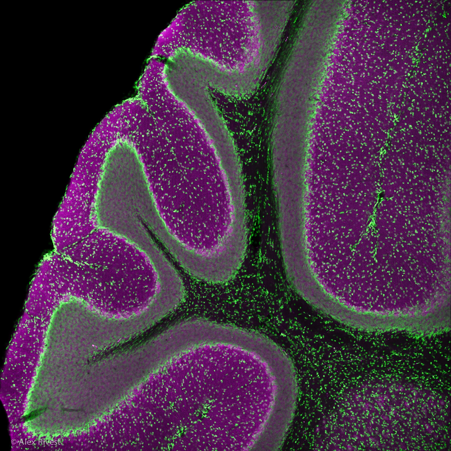 cerebellum1111111.JPG