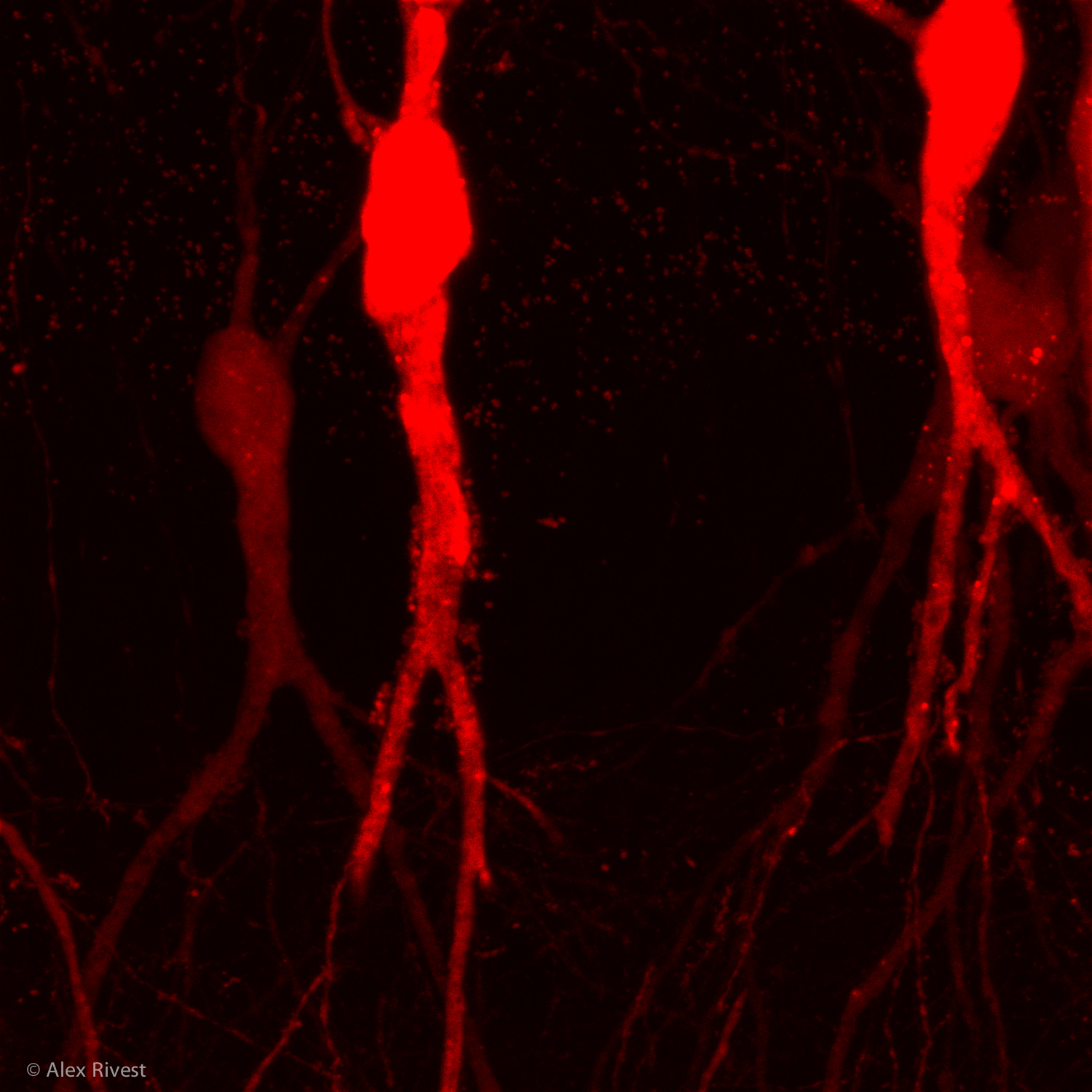 Image15_Maximumintensityprojection.JPG?f