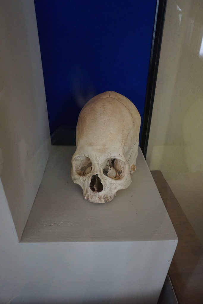A skull showing cranial deformation favored by nobles at the museum of Sillustani