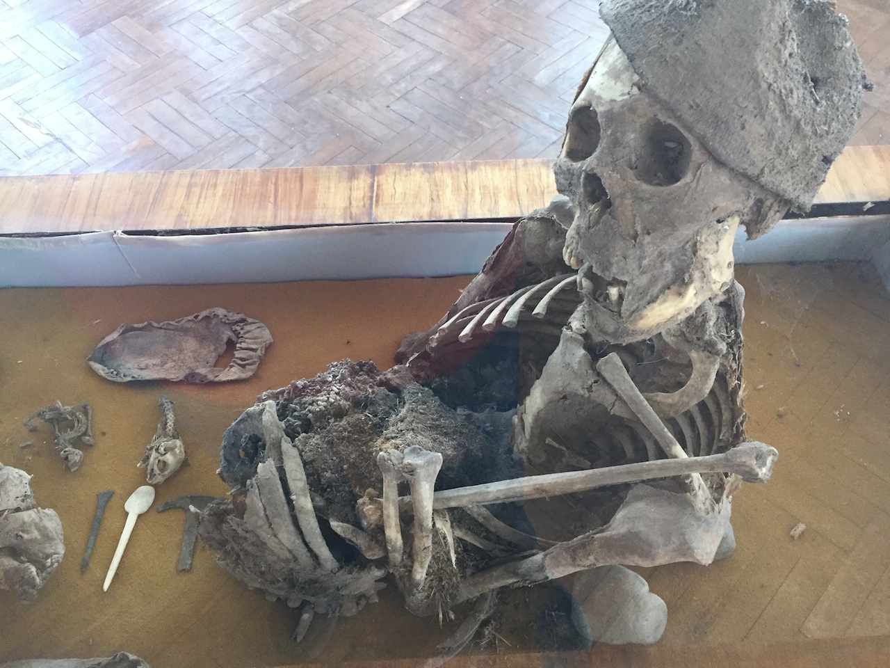  A partly mummified remain from the high Andes.&nbsp; 